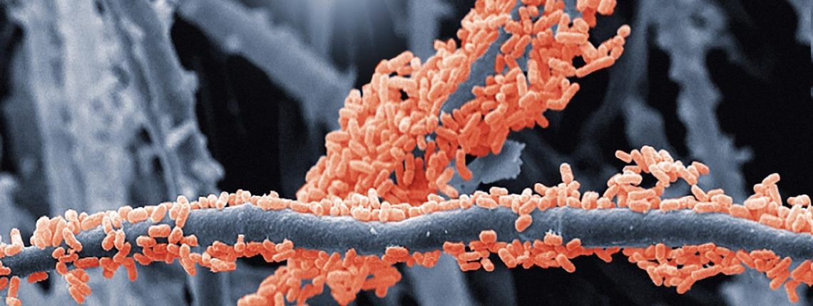 Die feinen Pilzfäden sind über und über von Bakterien besiedelt (rot eingefärbt). Das Bild zeigt einen Ausschnitt von etwa 50 mal 34 Mikrometern und stammt von einem Team um Anaële Simon von der Université de Neuchâtel